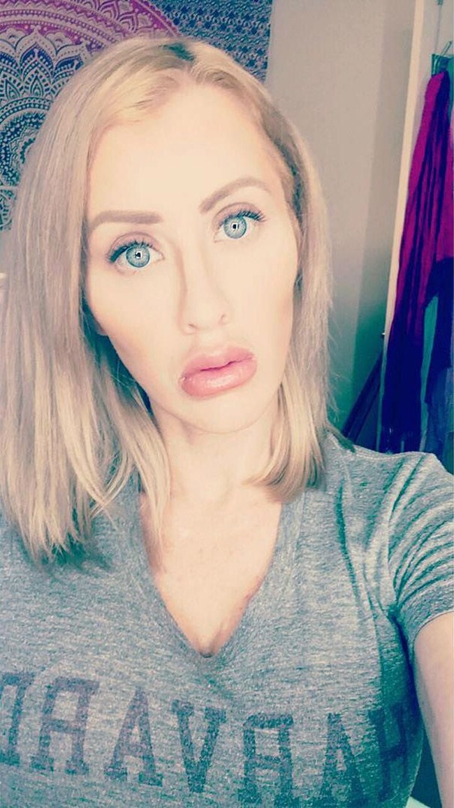 Ia juga melakukan pembesaran bokong serta pengencangan kulit leher.  Foto: Instagram