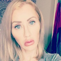 Ia juga melakukan pembesaran bokong serta pengencangan kulit leher.  Foto: Instagram