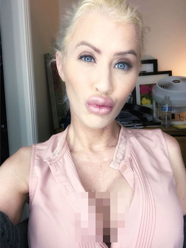 Wanita ini habiskan US$ 40 ribu atau sekitar Rp 550 juta untuk bertransformasi jadi Barbie. Ia melakukan beragam operasi plastik mulai dari filler bibir, implan payudara hingga bokong.  Foto: Instagram