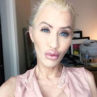 Wanita ini habiskan US$ 40 ribu atau sekitar Rp 550 juta untuk bertransformasi jadi Barbie. Ia melakukan beragam operasi plastik mulai dari filler bibir, implan payudara hingga bokong.  Foto: Instagram