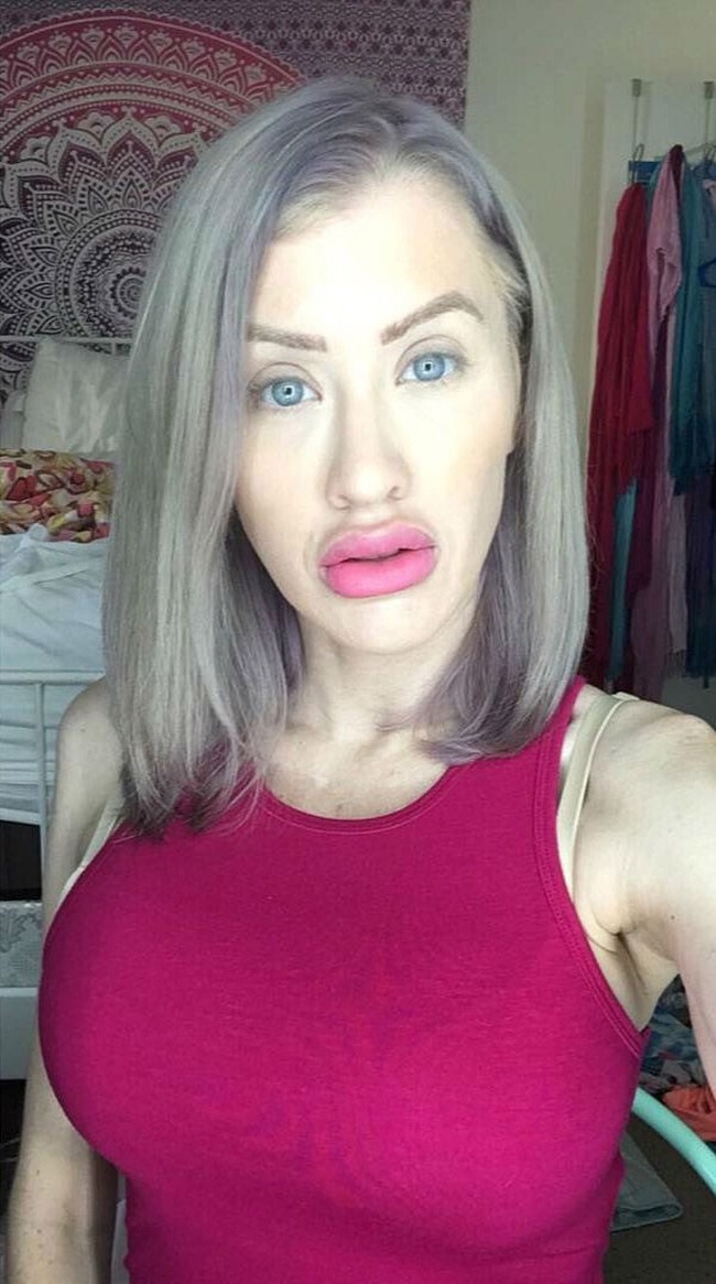 Di tahun yang sama, Katie menjalani operasi plastik pertamanya yakni implan payudara. Kini payudara Katie menjadi sangat besar dan tentu saja terlihat palsu.  Foto: Instagram