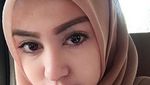 Ini Ariska Putri Pertiwi, si Dokter Cantik