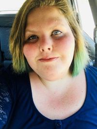 Kelainan Genetik, Wanita Ini Terus Merasa Lapar Meski Sudah Banyak Makan