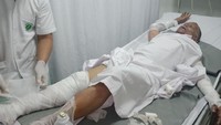 Terlihat perban yang menutupi luka bakar yang ada di bagian tubuh para korban. (Foto: dok. istimewa)