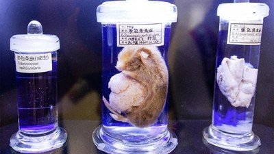 Foto: Museum Parasit di Tokyo yang Bikin Merinding