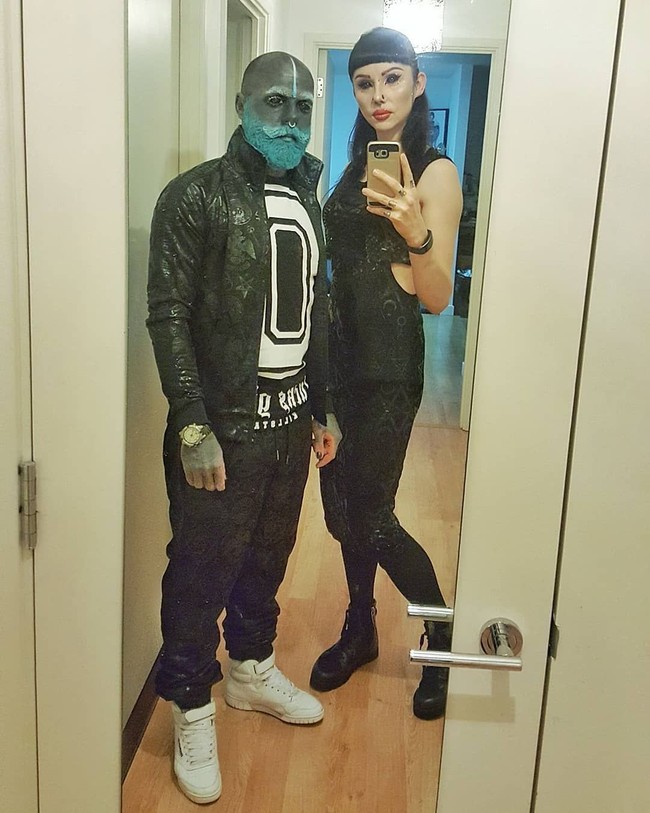 Sebelum mengubah seluruh tubuhnya menjadi berwarna hitam, Adam Curlykale menderita kanker usus besar. Dia pun menjalani berbagai pengobatan mulai dari radioterapi, kemoterapi, terapi molekular hingga terapi stem cell. Foto: Instagram/adam.curlykale