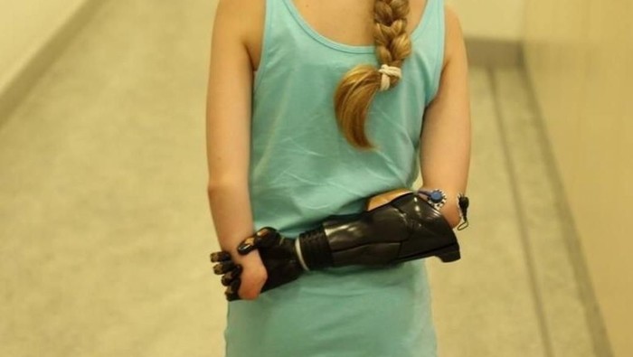 Ternyata Pasien Amputasi Masih Bisa Rasakan Anggota Tubuh yang Hilang