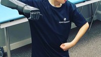 Seperti bocah ini yang bergaya layaknya pahlawan super. (Foto: Instagram/openbionics)