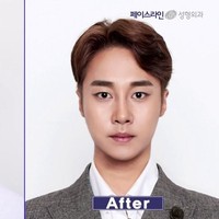Pria ini merekonstruksi bentuk mata, hidung dan rahangnya jadi lebih V-shape atau oval. Bentuk wajah yang dianggap ideal untuk orang Korea. Foto: dok. Koreaboo
