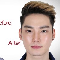 Sebelumnya mata pria ini terlihat lelah dan kuyu. Setelah operasi mata dan bentuk wajah, ia tampak lebih segar. Foto: dok. Koreaboo