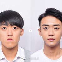 Pria ini juga mengubah rahangnya yang panjang jadi lebih proporsional. Foto: dok. Koreaboo