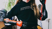 Tangan bionik bisa digunakan di dua tangan sekaligus. (Foto: Instagram/openbionics)
