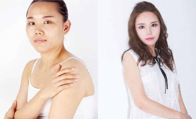 Wanita ini mengubah bentuk matanya jadi lebih besar. Ia juga terlihat membuat hidungnya lebih mancung. Foto: dok. Koreaboo