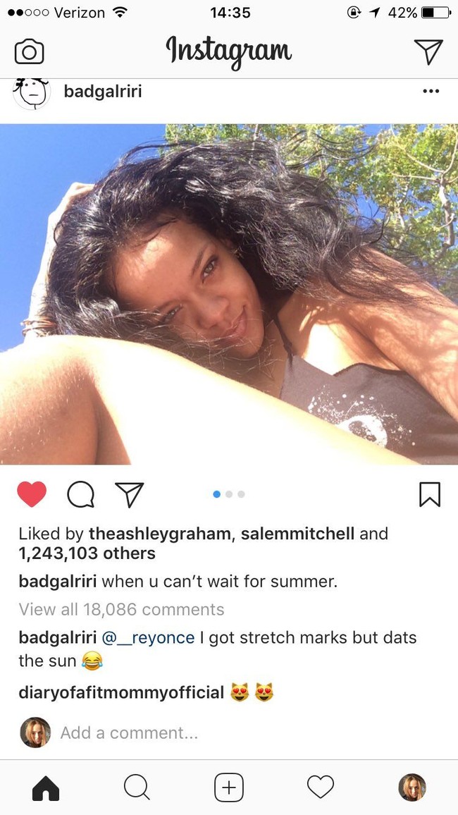Netizen juga terpaku bentuk guratan-guratan di bagian paha yang diduga sebagai stretch mark Rihanna. Aku melihat garis-garis bulu harimau Rih, tulis akun bernama @_reyonce. Tapi Rihanna mengklarifikasi itu bukan stretch mark. Aku punya stretch mark, tapi itu sinar matahari, tulis pelantun Kiss It Better. (Foto: Instagram/Rihanna)