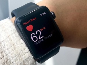 Apple Watch Nantinya Bisa Deteksi Parkinson