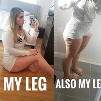 Memiliki tubuh yang berisi tidak menjadi masalah asal Anda sehat dan percaya diri. Begitu juga dengan selulit. Foto: Instagram @fitnessempire.x