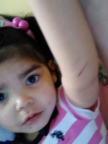 Ibu Meradang, Alis Anaknya Usia 2 Tahun Dicabuti Tanpa Izin di Daycare