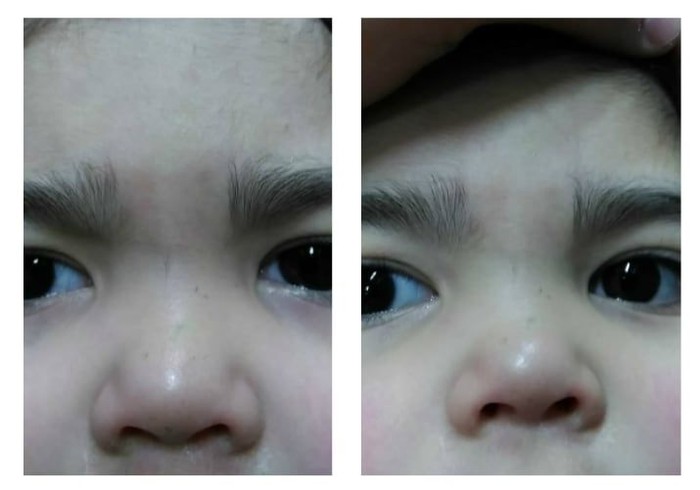 Alis Lilayiah yang sudah di-waxing. Foto: Dok. Buzfeed, Facebook Alis Lilayiah yang sudah di-waxing. Foto: Dok. Buzfeed, Facebook