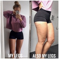 Belakangan di Instagram banyak selebgram fitness yang berbagi tips kebugaran. Meski terlihat langsing, seksi, bahkan atletis, mereka tak selalu sempurna. Seperti wanita ini yang mengungkap jika ia punya banyak selulit. Foto: Instagram @thefittestbody