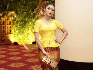 Cantiknya Prilly Latuconsina dan Citra Kirana di Nikahan Raditya Dika