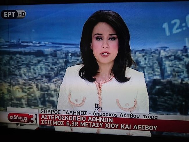 Hati-hati pilih blazer dengan aksen kantung klep begini. Jangan sampai baru sadar setelah ditonton ribuan orang. Foto: Istimewa