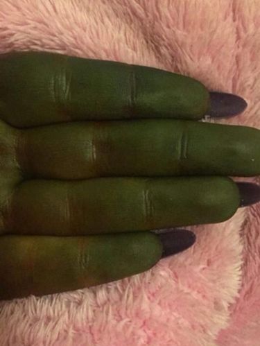 Ngeri! Pakai Krim Tanning Palsu, Kulit Wanita Ini Jadi Mirip Buto Ijo