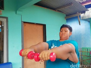 Video: Kisah Aria Permana, Bocah Super Gemuk Asal Karawang