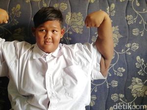 Curhat Aria Permana Obesitas Hingga 192 Kg