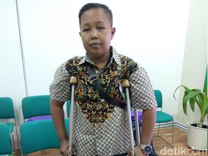 Idap Talasemia Sejak Bayi, Sekarang Oji Hidup dengan Satu Kaki