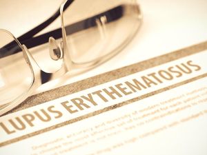 Apa Itu Penyakit Lupus? Kenali Gejala, Jenis, dan Cara Penanganannya