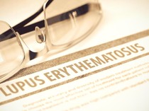 Apa Itu Penyakit Lupus? Kenali Gejala, Jenis, dan Cara Penanganannya