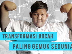 Video: Bahaya Obesitas Ekstrem Jika Tidak Segera Diatasi