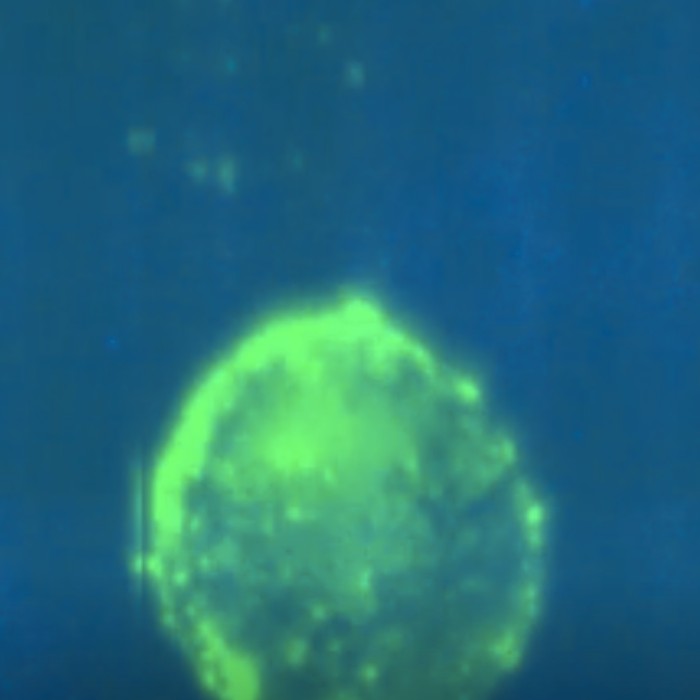 Apa yang tampak seperti serpihan hijau di bagian atas adalah partikel virus yang keluar dari sel. (Foto: Cell Reports) Apa yang tampak seperti serpihan hijau di bagian atas adalah partikel virus yang keluar dari sel. (Foto: Cell Reports)