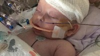 Dilansir dari ABC News, Rabu (9/5/2018), bayi tersebut bernama McKenna Hovenga. (Foto: Dok. Facebook Healing for McKenna via ABC News)