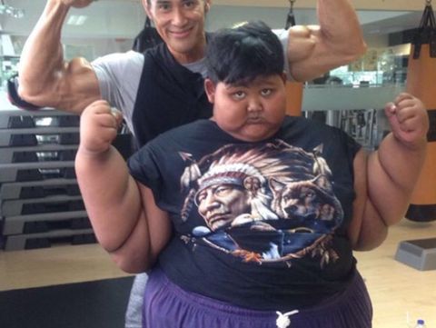 Aria Permana sebelum menjalani bedah bariatrik untuk mengecilkan lambung. 