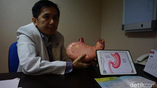 Ada beberapa metode yang bisa dilakukan untuk mengecilkan lambung.