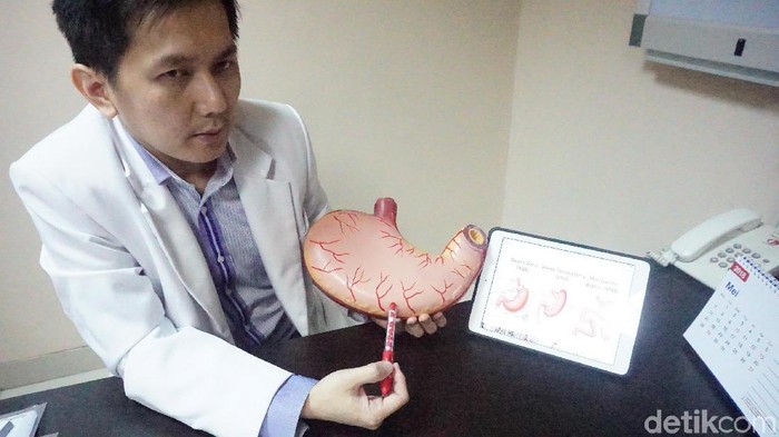 Gemuk dan Mau Operasi Bariatrik Lambung? Tak Sembarangan, Ini Syaratnya