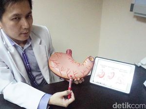 Bagaimana Operasi Lambung Bocah Tergemuk di Dunia Dilakukan?