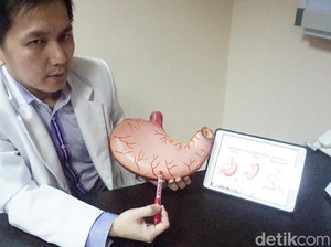 Bagaimana Operasi Lambung Bocah Tergemuk di Dunia Dilakukan?