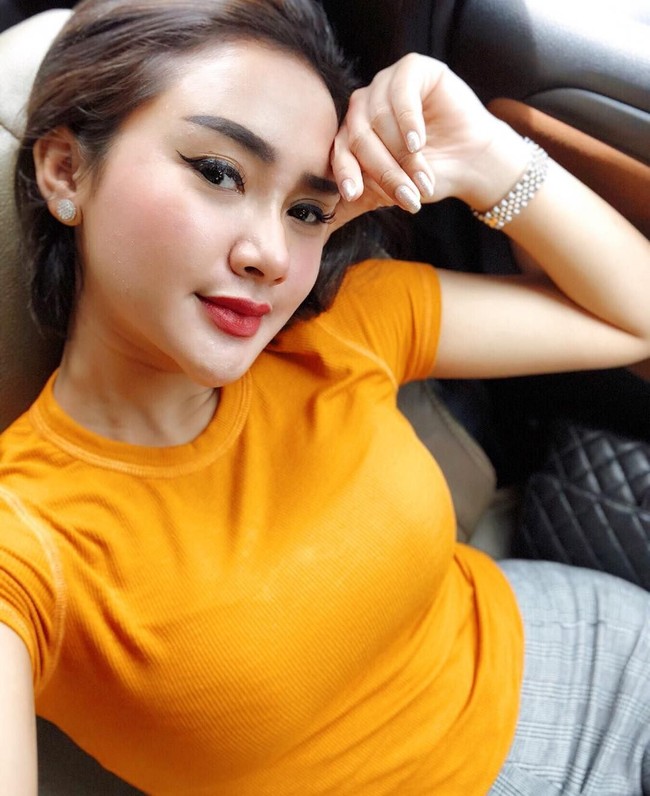 Penyanyi Cita Citata melakukan suntik filler di klinik kecantikan dr. Chen Aesthetic & Antiaging. Pelantun Sakitnya Tuh di Sini’ itu suntik filler pada area dagu untuk membuat wajah tampak oval atau v-shaped. Foto: Instagram