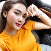 Penyanyi Cita Citata melakukan suntik filler di klinik kecantikan dr. Chen Aesthetic & Antiaging. Pelantun Sakitnya Tuh di Sini’ itu suntik filler pada area dagu untuk membuat wajah tampak oval atau v-shaped. Foto: Instagram