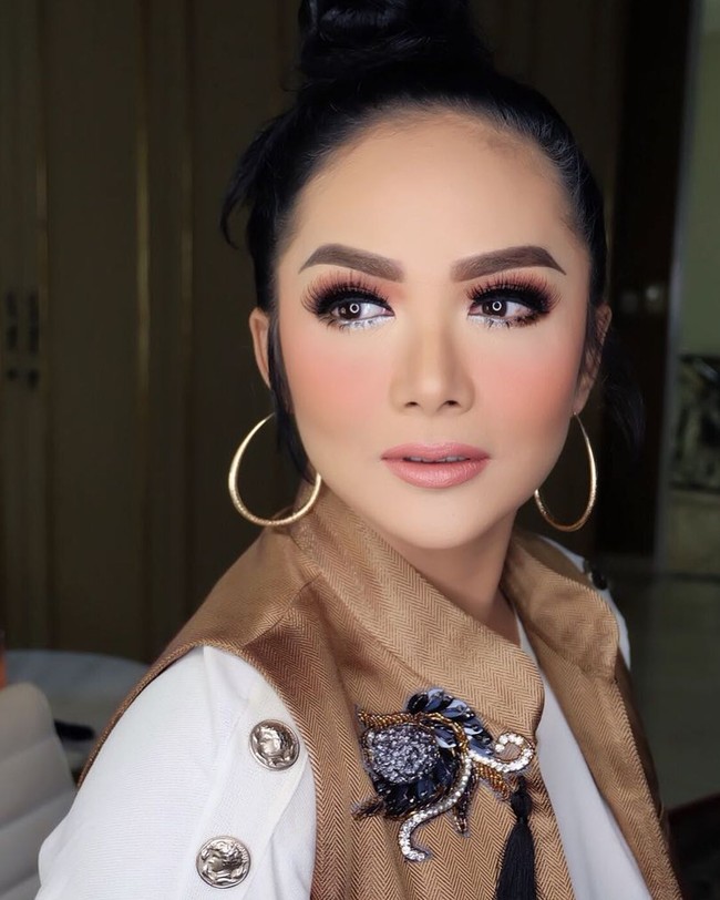 Penyanyi Krisdayanti juga termasuk pasien suntik filler dr. Chen yang memiliki klinik di kawasan Kembangan, Jakarta Barat. KD suntik filler pada area garis senyum atau smiling line. Foto: Instagram