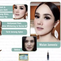Belum lama ini Mulan Jameela mengunggah video promo klinik kecantikan Dermaster. Dari video promo tersebut terlihat deretan foto-foto artis yang melakukan perawatan di Dermaster. Dan Mulan adalah salah satunya. Foto: Instagram Dermaster