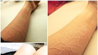 Salah seorang pengidap dermatographia menuturkan bahwa goresan yang timbul tidak membuatnya merasa sakit. (Foto: Instagram/rayjsader)