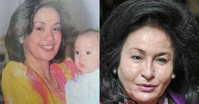 Inilah penampilan Rosmah Mansor pada 1989 ketika belum banyak melakukan tindakan bedah plastik. Saat itu usianya baru 38 tahun. Foto: Getty Images, Reuters, AFP