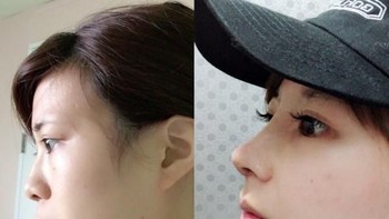 Untuk mendapatkan wajah yang super ini, ia rela menghabiskan uang senilai 7 juta yen atau setara dengan Rp 902 juta! (Foto: Twitter/meiji1111111)