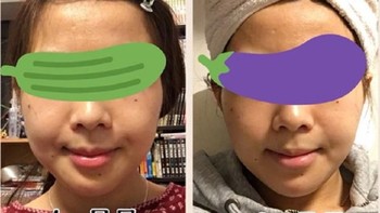 Foto ini menunjukkan perubahan wajah pasca operasi plastik yang sedang ia jalani mulai dari setelah dua minggu, satu bulan, hingga dua bulan. (Foto: Twitter/meiji1111111)