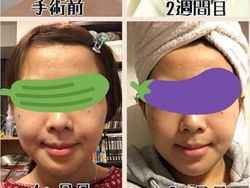 Transformasi Mengejutkan Wajah Cosplayer Pasca Oplas