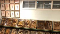 Beragam koleksi anatomi manusia di sini, ada yang perutnya terbuka, kepala tanpa kulit, potongan organ seperti jantung dan hati, dan lainnya. (gally76/Instagram)