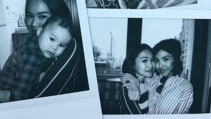 Salah satu gejala yang bisa menandakan kanker kulit melanoma adalah tahi lalat yang tidak normal (Foto: Instagram Adara Taista) Salah satu gejala yang bisa menandakan kanker kulit melanoma adalah tahi lalat yang tidak normal (Foto: Instagram Adara Taista)
